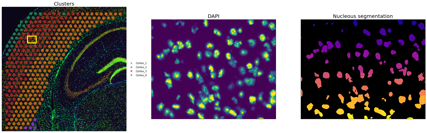 ../../_images/7eb2e188416d9d6585a65945121b9b5aee557e2dfbf579fec11e2d25ab97cb5b.png