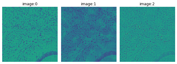 Nuclei segmentation using Cellpose — squidpy documentation